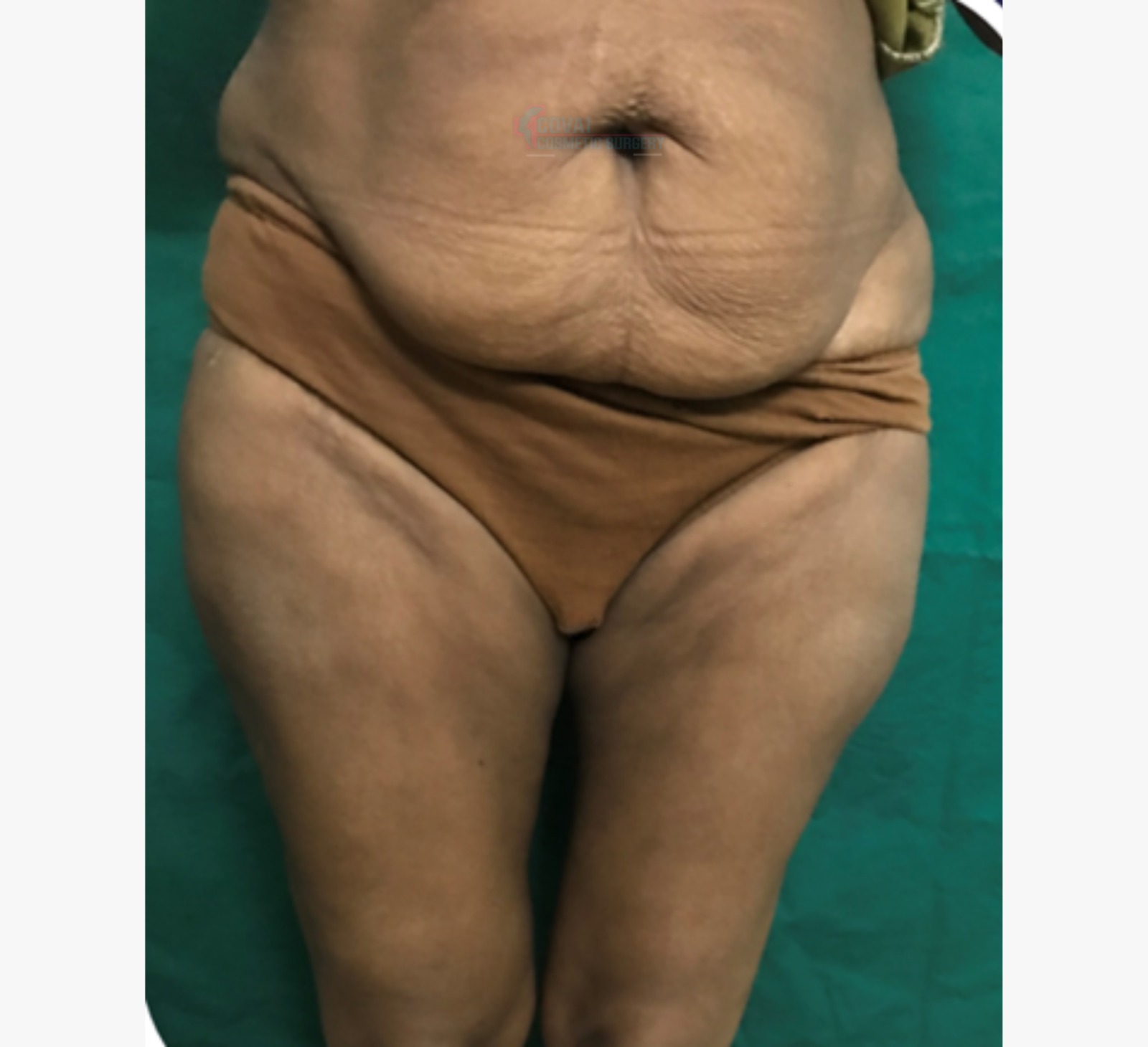 Transformation Case 6